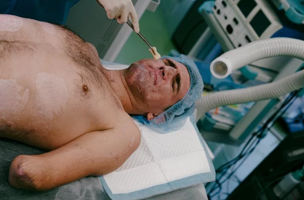 Захару Бірюкову довелося пройти стабілізацію і численні лікувально-відновлювальні курси